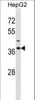IGBP1 Antibody - IGBP1 Antibody western blot of HepG2 cell line lysates (35 ug/lane). The IGBP1 antibody detected the IGBP1 protein (arrow).