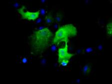 IGBP1 Antibody - Anti-IGBP1 mouse monoclonal antibody immunofluorescent staining of COS7 cells transiently transfected by pCMV6-ENTRY IGBP1.