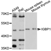 IGBP1 Antibody - Western blot analysis of extracts of various cell lines, using IGBP1 antibody at 1:1000 dilution. The secondary antibody used was an HRP Goat Anti-Rabbit IgG (H+L) at 1:10000 dilution. Lysates were loaded 25ug per lane and 3% nonfat dry milk in TBST was used for blocking. An ECL Kit was used for detection and the exposure time was 40s.