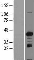 IGBP1 Protein - Western validation with an anti-DDK antibody * L: Control HEK293 lysate R: Over-expression lysate