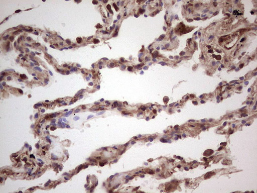IGF1 Antibody - Immunohistochemical staining of paraffin-embedded Human lung tissue within the normal limits using anti-IGF1 mouse monoclonal antibody. (Heat-induced epitope retrieval by 1 mM EDTA in 10mM Tris, pH8.5, 120C for 3min,