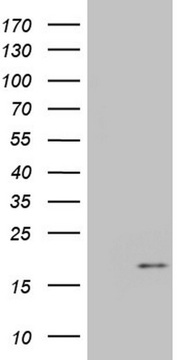 IGF1 Antibody - HEK293T cells were transfected with the pCMV6-ENTRY control (Left lane) or pCMV6-ENTRY IGF1 (Right lane) cDNA for 48 hrs and lysed. Equivalent amounts of cell lysates (5 ug per lane) were separated by SDS-PAGE and immunoblotted with anti-IGF1.