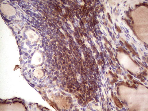 IGF1 Antibody - IHC of paraffin-embedded Human thyroid tissue using anti-IGF1 mouse monoclonal antibody. (Heat-induced epitope retrieval by 1 mM EDTA in 10mM Tris, pH8.5, 120°C for 3min).