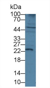 IGF1 Antibody - Western Blot; Sample: Rat Cerebrum lysate; ;Primary Ab: 3µg/ml Rabbit Anti-Human IGF1 Antibody;Second Ab: 0.2µg/mL HRP-Linked Caprine Anti-Rabbit IgG Polyclonal Antibody;(Catalog: SAA544Rb19