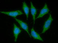 IGF1 Antibody - ICC/IF analysis of IGF1 in PC3 cells. The cell was stained with  IGF1 antibody (1:100).The secondary antibody (green) was used Alexa Fluor 488. DAPI was stained the cell nucleus (blue).