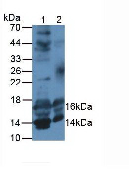 IGF1 Antibody - Western Blot; Samples. Lane1: Mouse Testis Tissue; Lane2: Mouse Uterus Tissue;