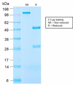 IGF1 Antibody - SDS-PAGE Analysis Purified IGF-1 Rabbit Recombinant Monoclonal Anitbody (IGF1/2872R). Confirmation of Purity and Integrity of Antibody.