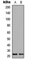 IGF1 Antibody - Western blot analysis of IGF1 expression in HepG2 (A); PC12 (B) whole cell lysates.