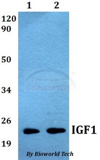 IGF1 Antibody - Western blot of IGF1 antibody at 1:500 dilution. Lane 1: HepG2 whole cell lysate. Lane 2: PC12 whole cell lysate.