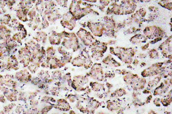 IGF1 Antibody - IHC of IGF-I (K149) pAb in paraffin-embedded human pancreas tissue.