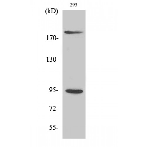 IGF1R / IGF1 Receptor Antibody - Western blot of Phospho-IGF-IR (Y1161) antibody