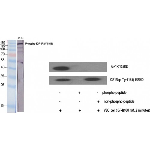 IGF1R / IGF1 Receptor Antibody - Western blot of Phospho-IGF-IR (Y1161) antibody