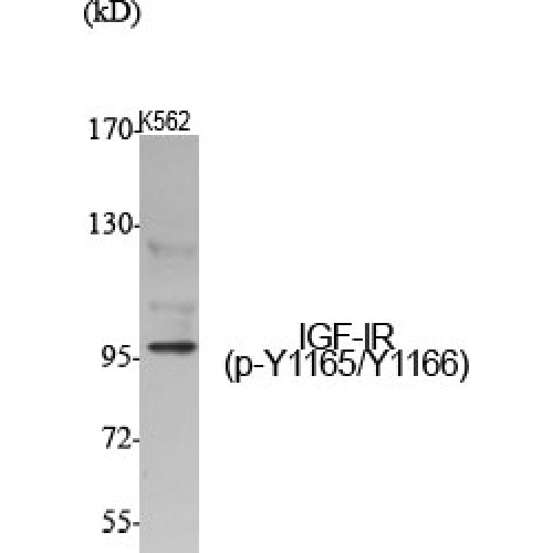 IGF1R / IGF1 Receptor Antibody - Western blot of Phospho-IGF-IR (Y1165/Y1166) antibody