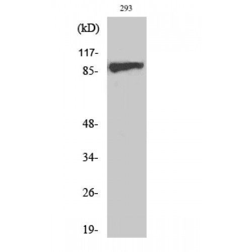 IGF1R / IGF1 Receptor Antibody - Western blot of Phospho-IGF-IR (Y1161) antibody