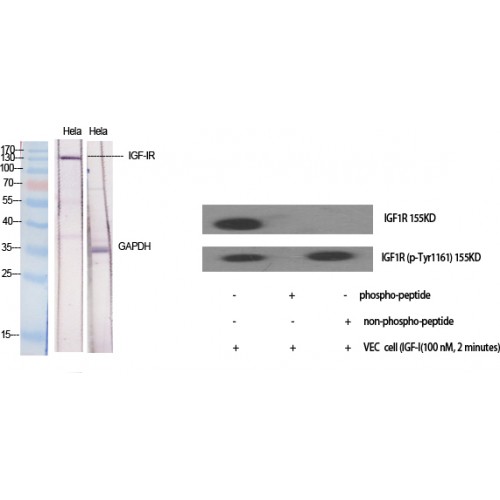 IGF1R / IGF1 Receptor Antibody - Western blot of IGF-IR antibody