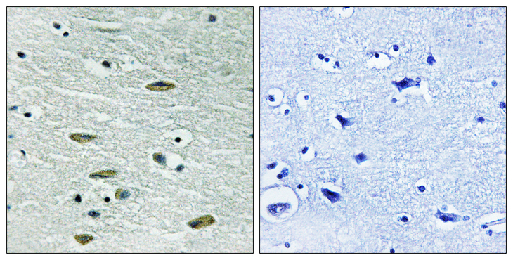 IGF1R / IGF1 Receptor Antibody - Immunohistochemistry analysis of paraffin-embedded human brain tissue, using IGF1R Antibody. The picture on the right is blocked with the synthesized peptide.