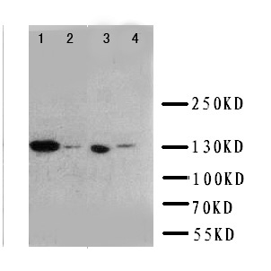 IGF1R / IGF1 Receptor Antibody - WB of IGF1R / IGF1 Receptor antibody. Lane 1: 293T Cell Lysate. Lane 2: A549 Cell Lysate . Lane 3: MCF-7 Cell Lysate.