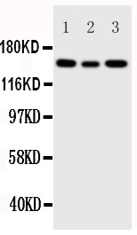 IGF1R / IGF1 Receptor Antibody - Anti-IGF1 Receptor antibody, Western blotting Lane 1: 293T Cell Lysate Lane 2: A549 Cell Lysate Lane 3: MCF-7 Cell Lysate