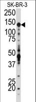 IGF1R / IGF1 Receptor Antibody - Western blot of anti-IGF1R Antibody in SK-BR-3 cell line lysates (35 ug/lane). IGF1R (arrow) was detected using the purified antibody.