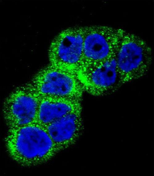 IGF1R / IGF1 Receptor Antibody - Confocal immunofluorescence of IGF1R Antibody (N-term K66) with WiDr cell followed by Alexa Fluor 488-conjugated goat anti-rabbit lgG (green). DAPI was used to stain the cell nuclear (blue).