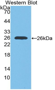 IGF1R / IGF1 Receptor Antibody - Western blot of recombinant IGF1R / IGF1 Receptor.