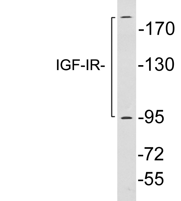 IGF1R / IGF1 Receptor Antibody - Western blot analysis of lysates from SKOV3 cells, using IGF-IR antibody.