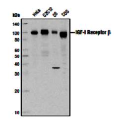 IGF1R / IGF1 Receptor Antibody - Western blot of various cell extracts using Insulin-Like Growth Factor I Receptor, beta (IGF1Rb).