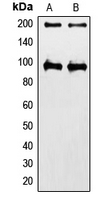 IGF1R / IGF1 Receptor Antibody - Western blot analysis of IGF1 Receptor expression in HeLa (A); MCF7 (B) whole cell lysates.