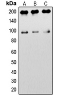 IGF1R / IGF1 Receptor Antibody - Western blot analysis of IGF1 Receptor expression in HeLa (A); NIH3T3 (B); rat brain (C) whole cell lysates.