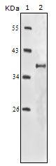 IGF1R / IGF1 Receptor Antibody - Western blot analysis using IGF1R monoclonal antibody against truncated IGF1R recombinant protein.