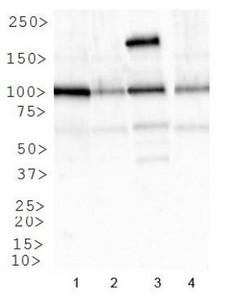IGF1R / IGF1 Receptor Antibody - Western Blot: IGF1 Receptor Antibody - Analysis of IGFR1 in: 1. HeLa, 2. NIH/3T3, 3. SK-BR-3 and 4. COS7.  This image was taken for the unconjugated form of this product. Other forms have not been tested.