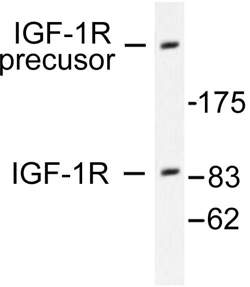 IGF1R / IGF1 Receptor Antibody - Western blot of IGF-1R (G1155) antibody in extracts from 293 cells treated with Insulin.