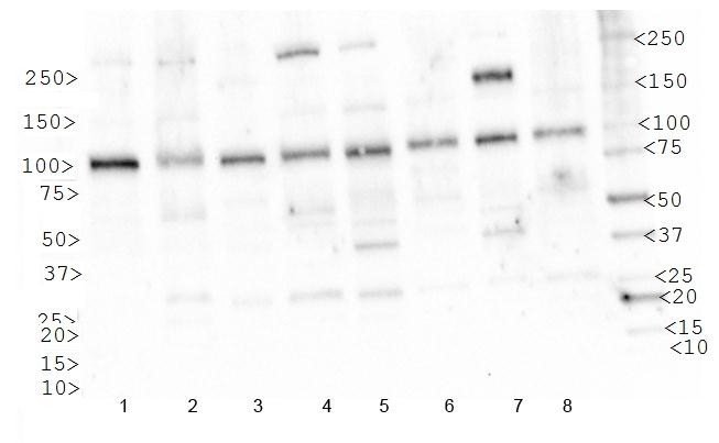IGF1R / IGF1 Receptor Antibody - Western Blot: IGF1 Receptor Antibody - Analysis of IGF1R in 1. HeLa, 2. Ntera2, 3. A431, 4. HepG2, 5. MCF7, 6. NIH/3T3, 7. SK-BR-3 and 8. COS7.  This image was taken for the unconjugated form of this product. Other forms have not been tested.