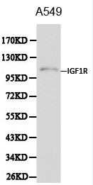 IGF1R / IGF1 Receptor Antibody - Western blot of IGF-I Receptor beta pAb in extracts from A549 cells.