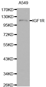 IGF1R / IGF1 Receptor Antibody - Western blot analysis of extracts of A549 cells.