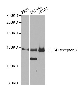 IGF1R / IGF1 Receptor Antibody - Western blot analysis of extracts of various cell lines, using IGF1R antibody at 1:1000 dilution. The secondary antibody used was an HRP Goat Anti-Rabbit IgG (H+L) at 1:10000 dilution. Lysates were loaded 25ug per lane and 3% nonfat dry milk in TBST was used for blocking. An ECL Kit was used for detection and the exposure time was 90s.
