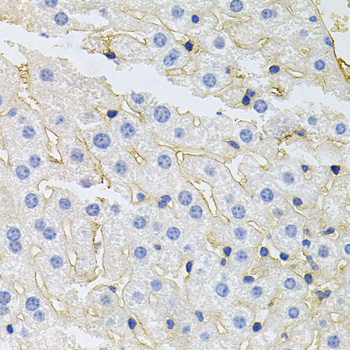 IGF1R / IGF1 Receptor Antibody - Immunohistochemistry of paraffin-embedded mouse liver using IGF1R antibodyat dilution of 1:100 (40x lens).