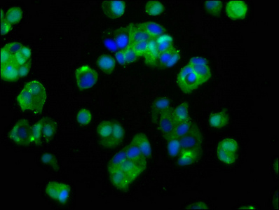 IGF1R / IGF1 Receptor Antibody - Immunofluorescence staining of MCF-7 cells with IGF1R Antibody at 1:400, counter-stained with DAPI. The cells were fixed in 4% formaldehyde, permeabilized using 0.2% Triton X-100 and blocked in 10% normal Goat Serum. The cells were then incubated with the antibody overnight at 4°C. The secondary antibody was Alexa Fluor 488-congugated AffiniPure Goat Anti-Rabbit IgG(H+L).