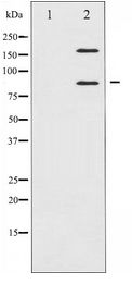 IGF1R / IGF1 Receptor Antibody - Western blot of IGF1R expression in Insulin treated 293 whole cell lysates,The lane on the left is treated with the antigen-specific peptide.