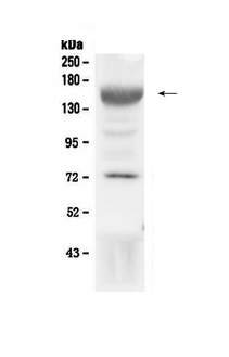 IGF1R / IGF1 Receptor Antibody - Western blot - Anti-IGF1 Receptor Picoband Antibody