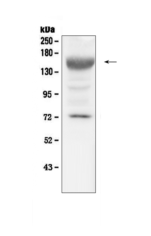 IGF1R / IGF1 Receptor Antibody - Western blot analysis of IGF1 Receptor using anti-IGF1 Receptor antibody. Electrophoresis was performed on a 5-20% SDS-PAGE gel at 70V (Stacking gel) / 90V (Resolving gel) for 2-3 hours. The sample well of each lane was loaded with 50ug of sample under reducing conditions. Lane 1: mouse liver tissue lysates. After Electrophoresis, proteins were transferred to a Nitrocellulose membrane at 150mA for 50-90 minutes. Blocked the membrane with 5% Non-fat Milk/ TBS for 1.5 hour at RT. The membrane was incubated with rabbit anti-IGF1 Receptor antigen affinity purified polyclonal antibody at 0.5 ug/mL overnight at 4?, then washed with TBS-0.1% Tween 3 times with 5 minutes each and probed with a goat anti-rabbit IgG-HRP secondary antibody at a dilution of 1:10000 for 1.5 hour at RT. The signal is developed using an Enhanced Chemiluminescent detection (ECL) kit with Tanon 5200 system. A specific band was detected for IGF1 Receptor at approximately 155KD. The expected band size for IGF1 Receptor is at 155KD.