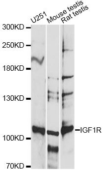 IGF1R / IGF1 Receptor Antibody - Western blot analysis of extracts of various cell lines, using IGF1R antibody at 1:1000 dilution. The secondary antibody used was an HRP Goat Anti-Rabbit IgG (H+L) at 1:10000 dilution. Lysates were loaded 25ug per lane and 3% nonfat dry milk in TBST was used for blocking. An ECL Kit was used for detection and the exposure time was 15s.