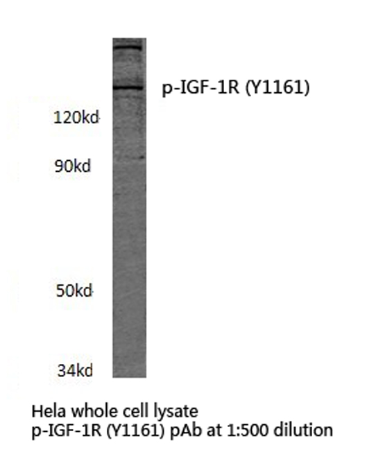 IGF1R / IGF1 Receptor Antibody - Western blot of p-IGF-1R (Y1161) pAb in extracts from HeLa cells.