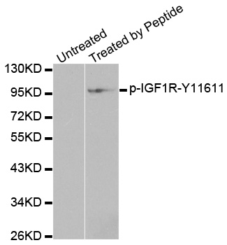 IGF1R / IGF1 Receptor Antibody - Western blot analysis of extracts from 293 cells.