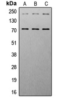 IGF1R / IGF1 Receptor Antibody - Western blot analysis of IGF1 Receptor (pY1161) expression in HeLa (A); NIH3T3 (B); mouse heart (C) whole cell lysates.
