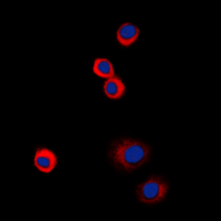 IGF1R / IGF1 Receptor Antibody - Immunofluorescent analysis of IGF1 Receptor (pY1161) staining in HeLa cells. Formalin-fixed cells were permeabilized with 0.1% Triton X-100 in TBS for 5-10 minutes and blocked with 3% BSA-PBS for 30 minutes at room temperature. Cells were probed with the primary antibody in 3% BSA-PBS and incubated overnight at 4 C in a humidified chamber. Cells were washed with PBST and incubated with a DyLight 594-conjugated secondary antibody (red) in PBS at room temperature in the dark. DAPI was used to stain the cell nuclei (blue).