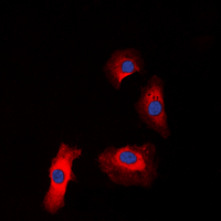 IGF1R / IGF1 Receptor Antibody - Immunofluorescent analysis of IGF1 Receptor (pY1161) staining in HeLa cells. Formalin-fixed cells were permeabilized with 0.1% Triton X-100 in TBS for 5-10 minutes and blocked with 3% BSA-PBS for 30 minutes at room temperature. Cells were probed with the primary antibody in 3% BSA-PBS and incubated overnight at 4 deg C in a humidified chamber. Cells were washed with PBST and incubated with a DyLight 594-conjugated secondary antibody (red) in PBS at room temperature in the dark. DAPI was used to stain the cell nuclei (blue).