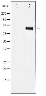 IGF1R / IGF1 Receptor Antibody - Western blot of IGF1R phosphorylation expression in Insulin treated 293 whole cell lysates,The lane on the left is treated with the antigen-specific peptide.