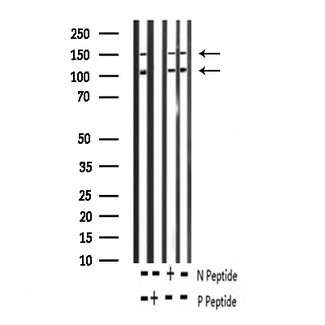 IGF1R / IGF1 Receptor Antibody - Western blot analysis of Phospho-IGF1R (Tyr1161) expression in various lysates