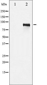 IGF1R / IGF1 Receptor Antibody - Western blot analysis of IGF1R phosphorylation expression in Insulin treated 293 whole cells lysates. The lane on the left is treated with the antigen-specific peptide.